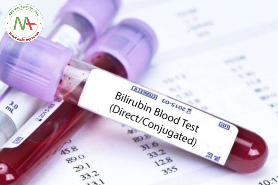 Ý nghĩa của xét nghiệm chỉ số bilirubin 