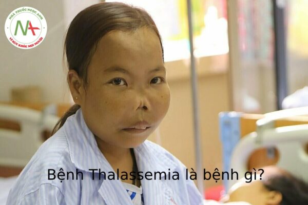 Bệnh Thalassemia là bệnh gì?
