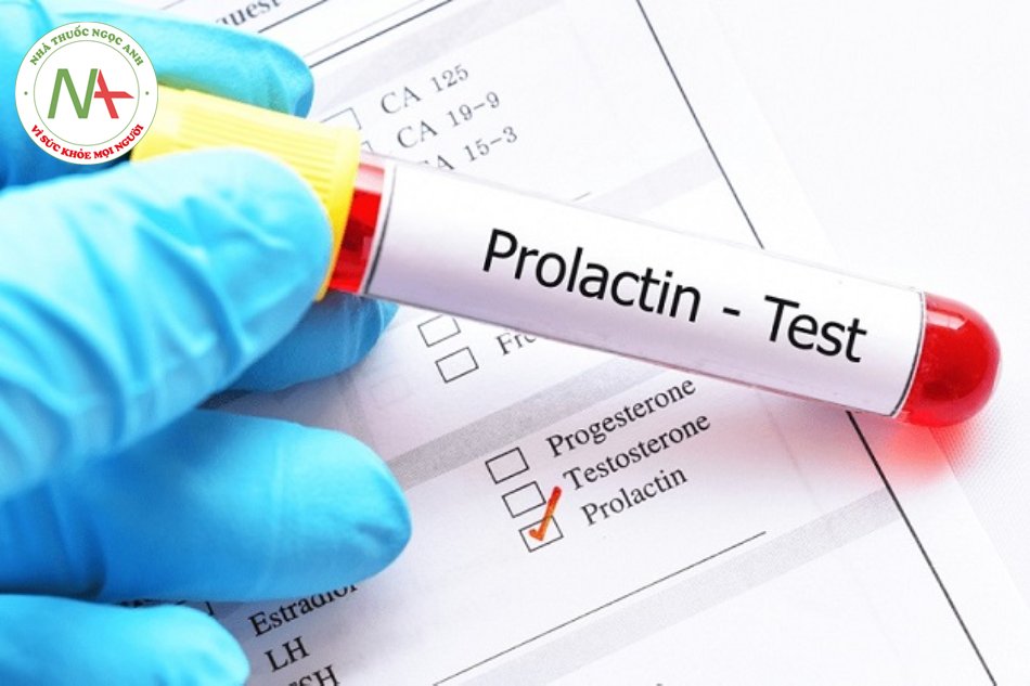 Cách chẩn đoán chỉ số prolactin cao