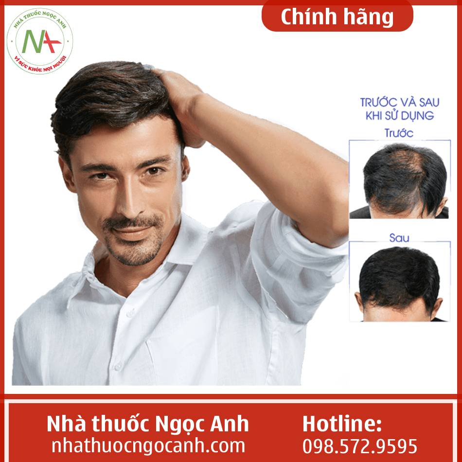 Hiệu quả của Qik hair for men
