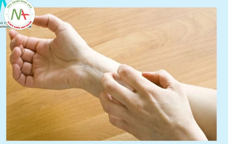 Blisters: Pictures, Causes, and Outlook