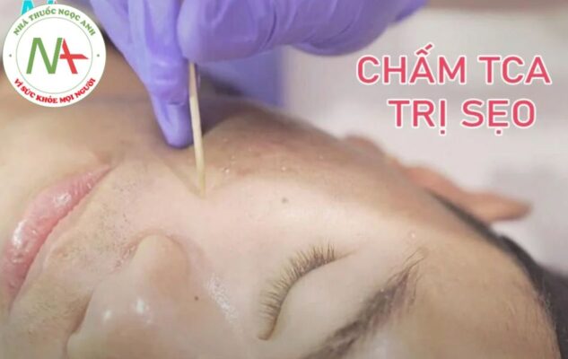 Chấm TCA trị sẹo