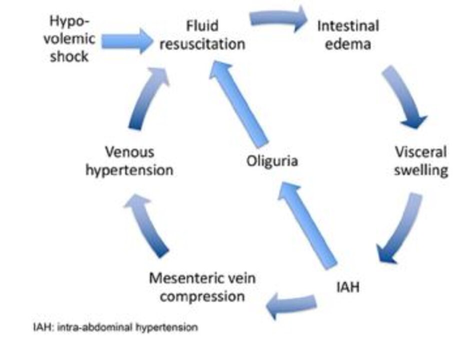 Hình 1: Vòng luẩn quẩn của hồi sức sốc nhiễm trùng. Adapted from Peeters et al. with permission [96]. IAH: intra-abdominal hypertension