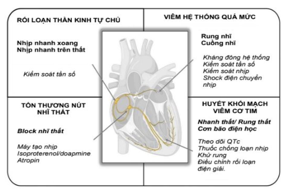 Hình…. Rối loạn nhịp tim trong và sau khi nhiễm COVID-19. Hình này minh họa ảnh hưởng của nhiễm COVID-19 đối với hệ thống dẫn truyền của tim, phổ của rối loạn nhịp tim và các chiến lược xử trí cần xem xét.