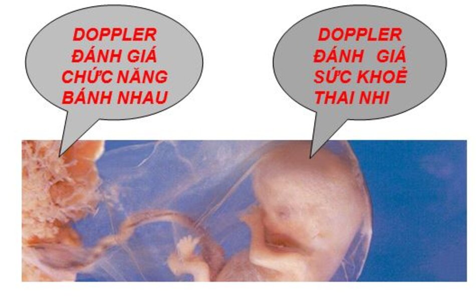 Doppler đánh giá chức năng bánh nhau và sức khỏe thai nhi
