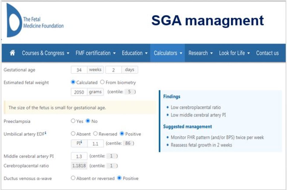 SGA managment