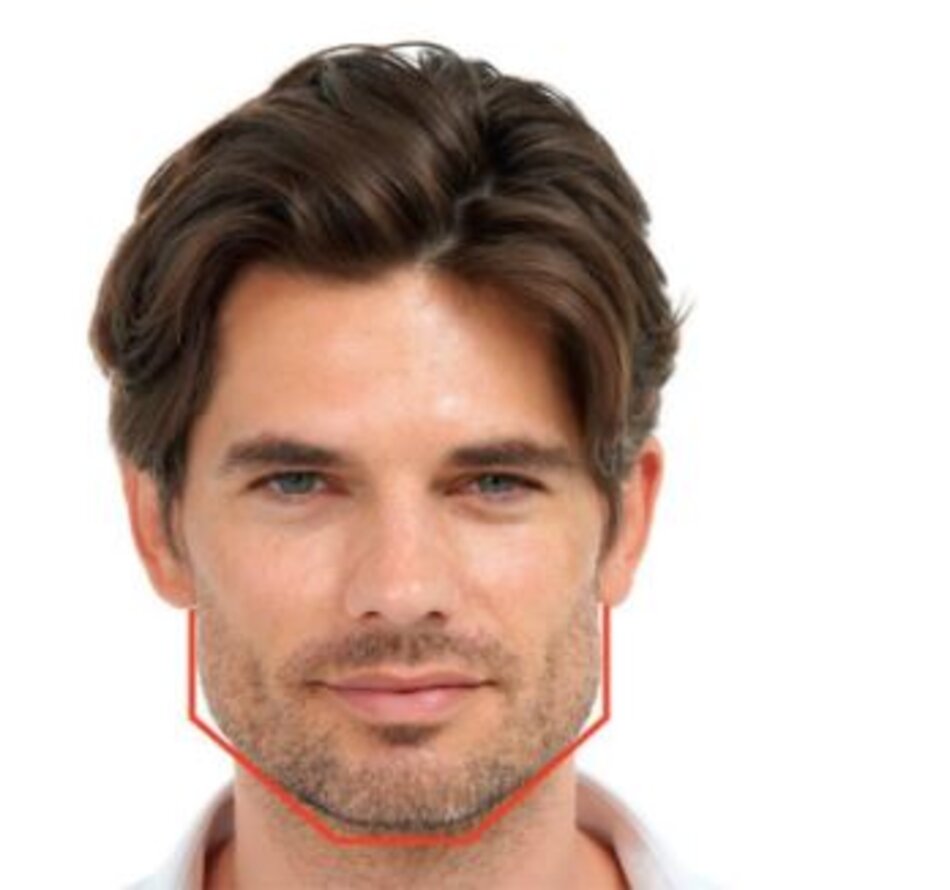 Hình 3.7 Cơ cắn to và góc hàm mạnh mẽ ở mặt nam giới.