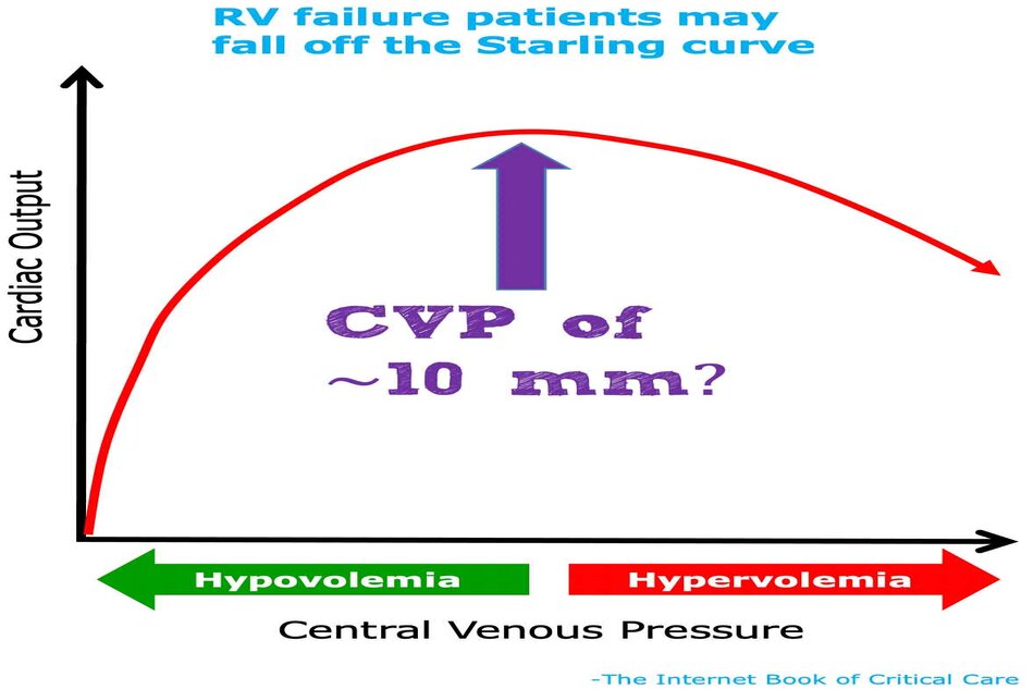 Áp lực tĩnh mạch trung tâm (CVP)