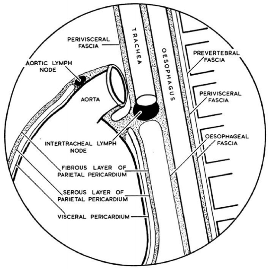 Hình 1 Sơ đồ minh họa cấu trúc giải phẫu của màng ngoài tim; vùng chấm chấm thể hiện mặt phẳng mô liên kết dưới cân mạc