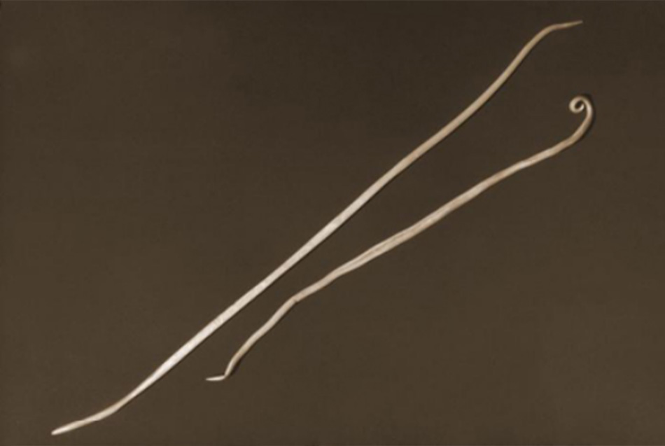 Hình 1: Photograph of 2 Ascaris lumbricoides nematodes; the larger one on the left is female and that on the right is male. Adult females can grow to >30 cm (12 in) in length