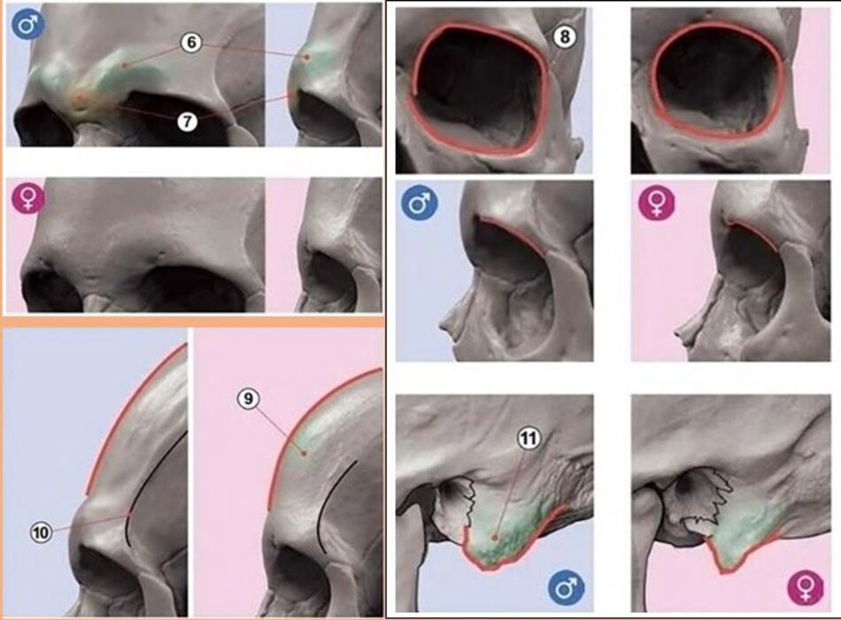 Sự khác biệt trong đường nét và khối xương sọ giữa nam và nữ