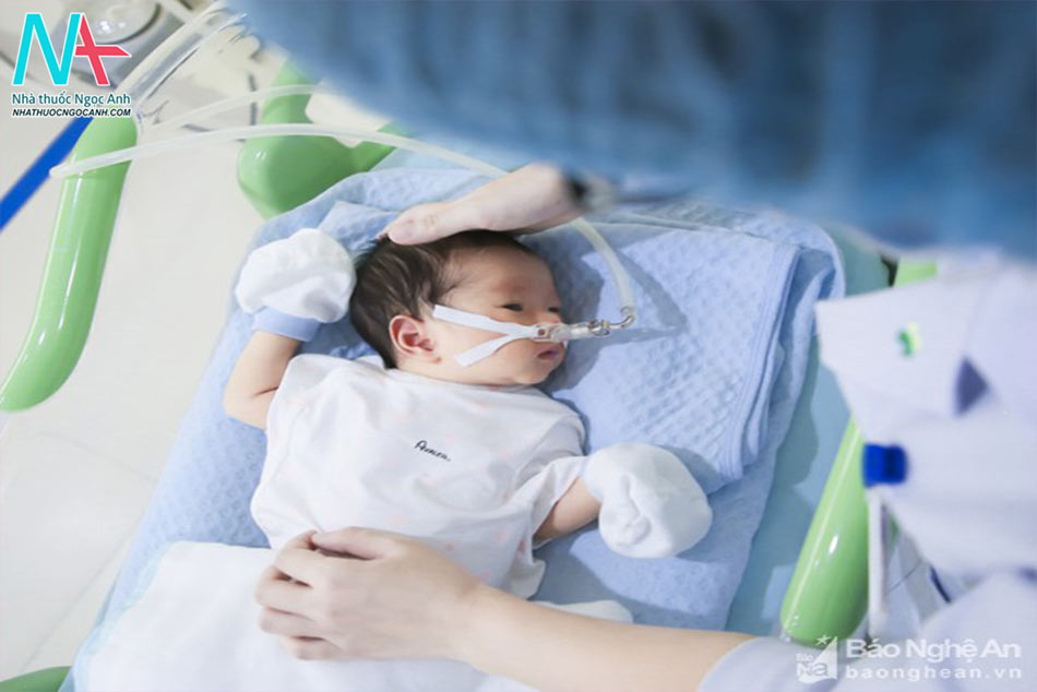 Điều trị suy hô hấp ở trẻ sơ sinh bằng thở áp lực dương liên tục
