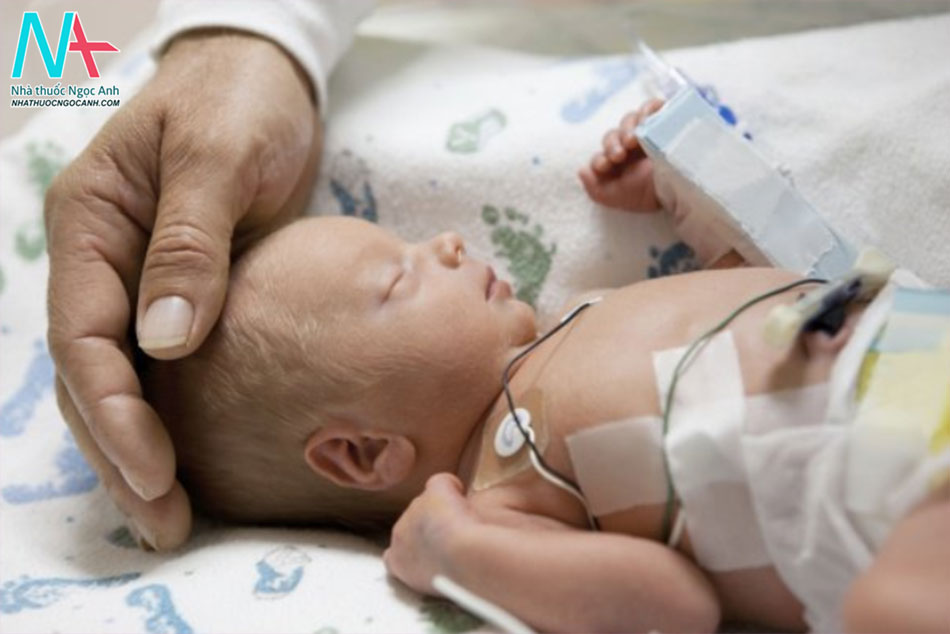 Suy hô hấp ở trẻ sơ sinh là gì?