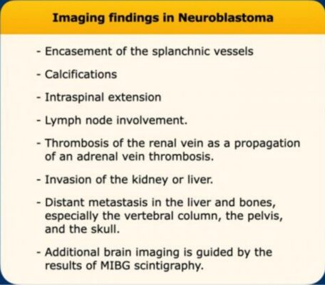 Imageing findings in Neuroblastoma