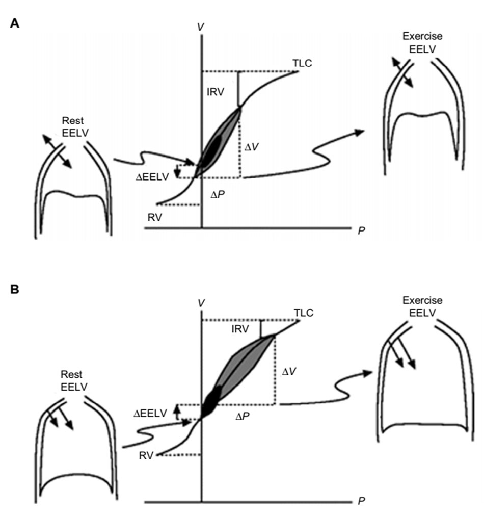 Hình 2 Mối quan hệ áp lực - thể tích của tổng hệ hô hấp