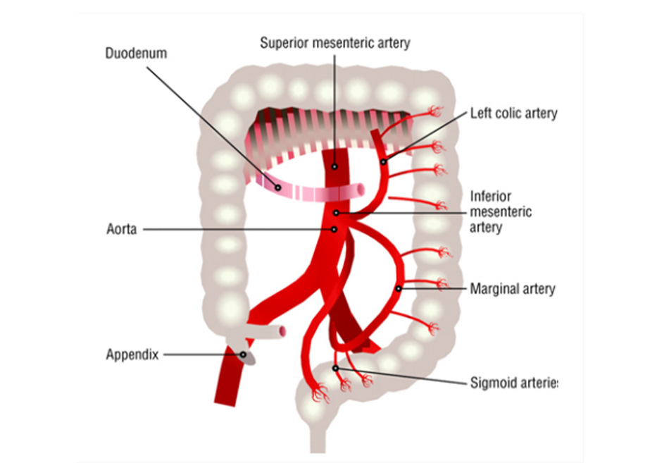 Hình 2: Sự phân bố lưu lượng máu đến đại tràng, xuất phát từ động mạch mạc treo tràng dưới, các nhánh của động mạch bao gồm động mạch đại tràng trái, động mạch viền và động mạch sigma và các nhánh này cung cấp máu cho đại tràng trái và đoạn trên của trực tràng. 