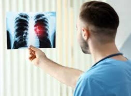 Các nguyên nhân tổn thương phổi do máy thở tổn thương cơ học