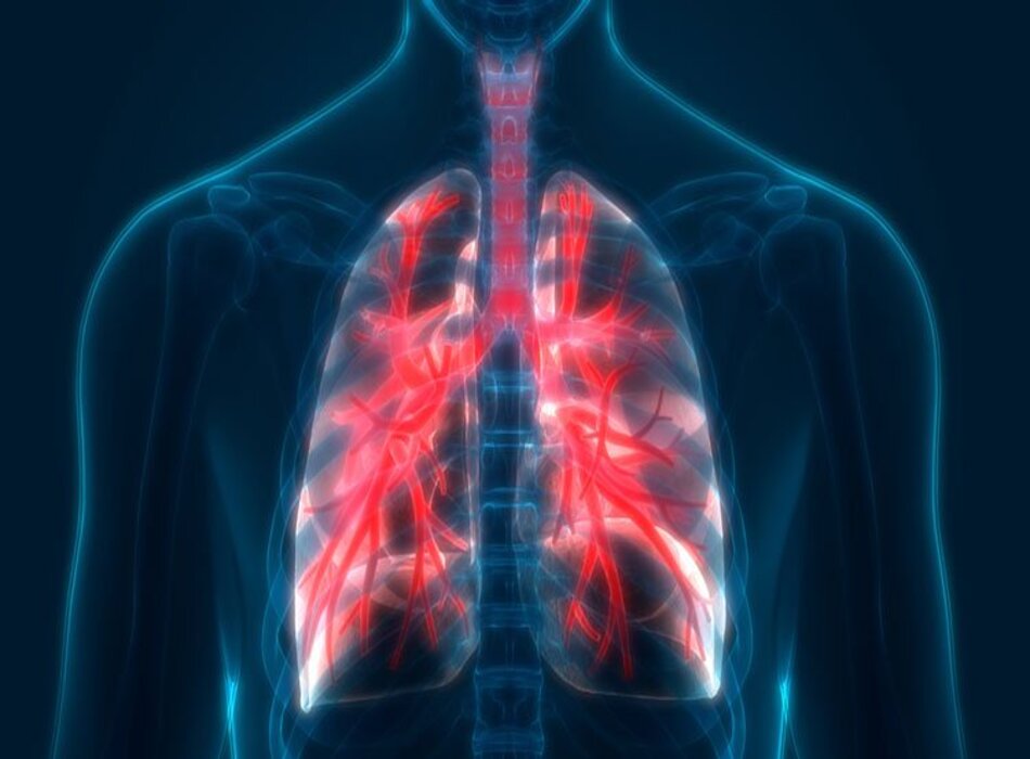 Cách thông khí cho bệnh nhân bị bệnh phổi tắc nghẽn và hen suyễn