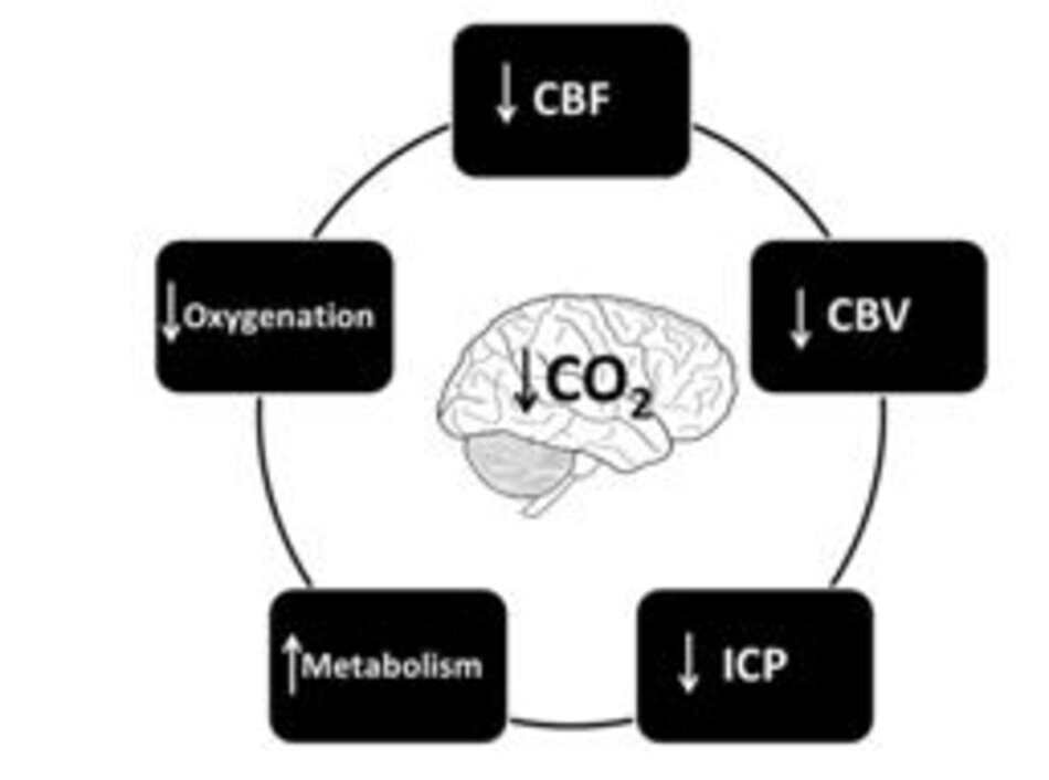 Hình 3. Ảnh hưởng đến não của tình trạng giảm CO2 máu