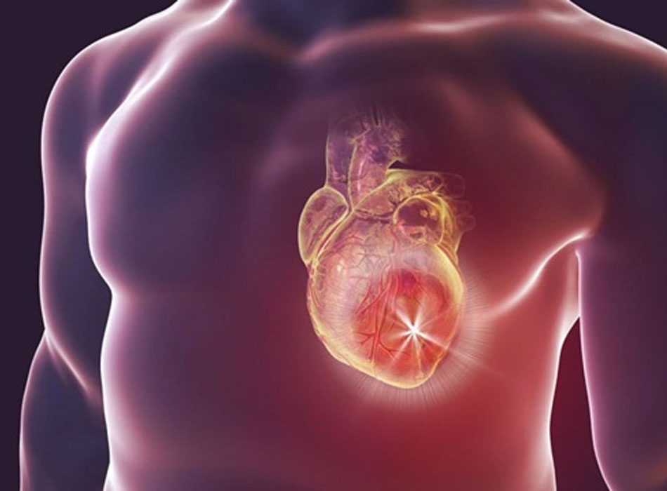 Đợt cấp của suy tim sung huyết: Cách phòng ngừa, chẩn đoán và điều trị theo BMJ