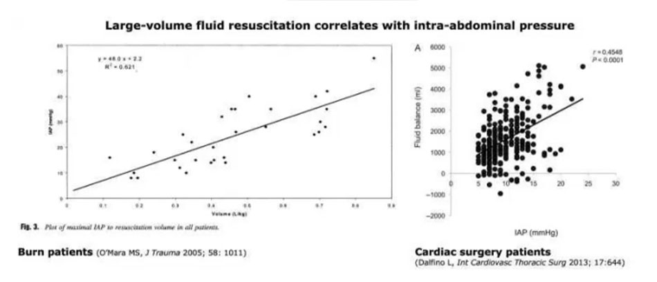 Large-volume fluid resusitation correlates with intra-abdominal pressure