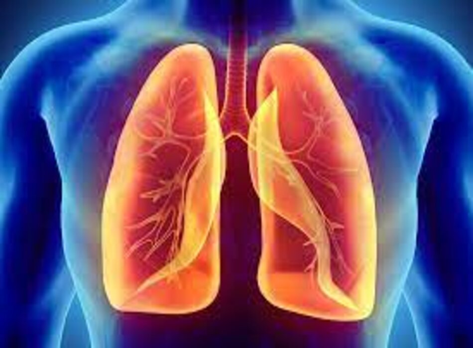 Tổn thương phổi do thuốc: báo cáo trường hợp tổn thương phế nang lan tỏa do quá liều thuốc nhóm SSRIs - PAROXETINE