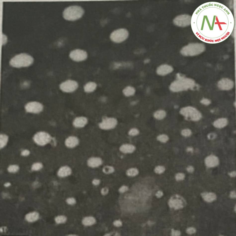 Hình 30. Hình ảnh TEM của nano lipid rắn chứa nọc độc cóc
