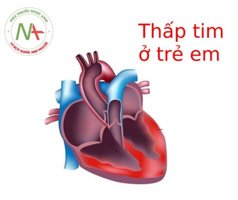 Thấp tim ở trẻ em