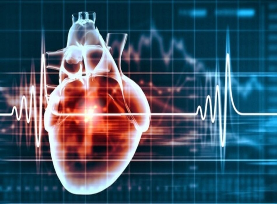 Tổng quan về rối loạn nhịp tim chậm