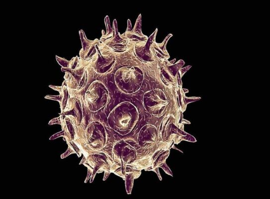 Nhiễm virus herpes zoster: Nguyên nhân, chẩn đoán và hướng dẫn điều trị theo BMJ