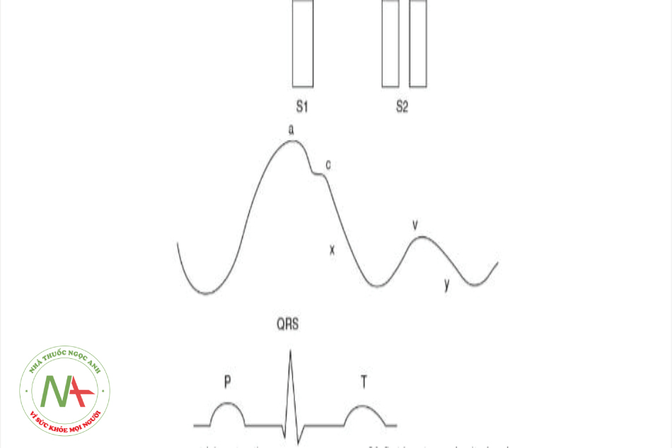 Hình 10.4: Đường ghi áp lực tĩnh mạch trung tâm bình thường 