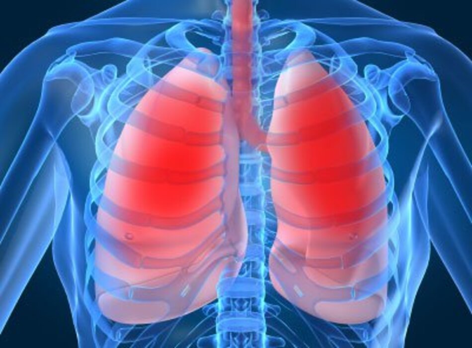Hội chứng suy hô hấp cấp tính: Nguyên nhân, chẩn đoán và phương pháp điều trị theo BMJ