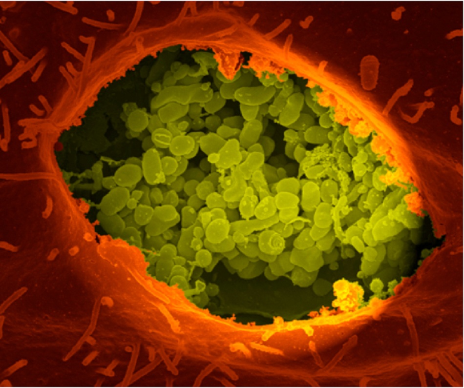 Hình 2: Coxiella burnetii trong không bào. Tế bào vero bị nứt khô tiếp xúc với các thành phần không bào, nơi vi khuẩn Coxiella burnetii đang phát triển