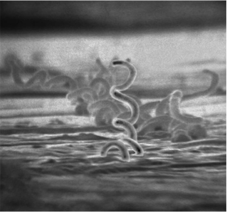 Hình 1: Ảnh hiển vi điện tử Treponema pallidum khi nuôi cấy tế bào biểu mô thỏ đuôi bông