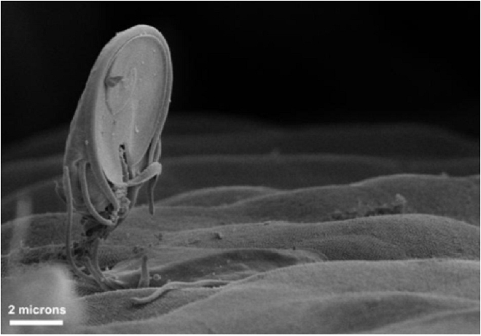 Hình 1: Quét ảnh hiển vi điện tử của thể tư dưỡng Giardia trên bề mặt niêm mạc ruột. Có thể quan sát thấy đĩa bám dính ở bụng của ký sinh trùng, đĩa này giúp cho việc bám dính bề mặt ruột dễ dàng.