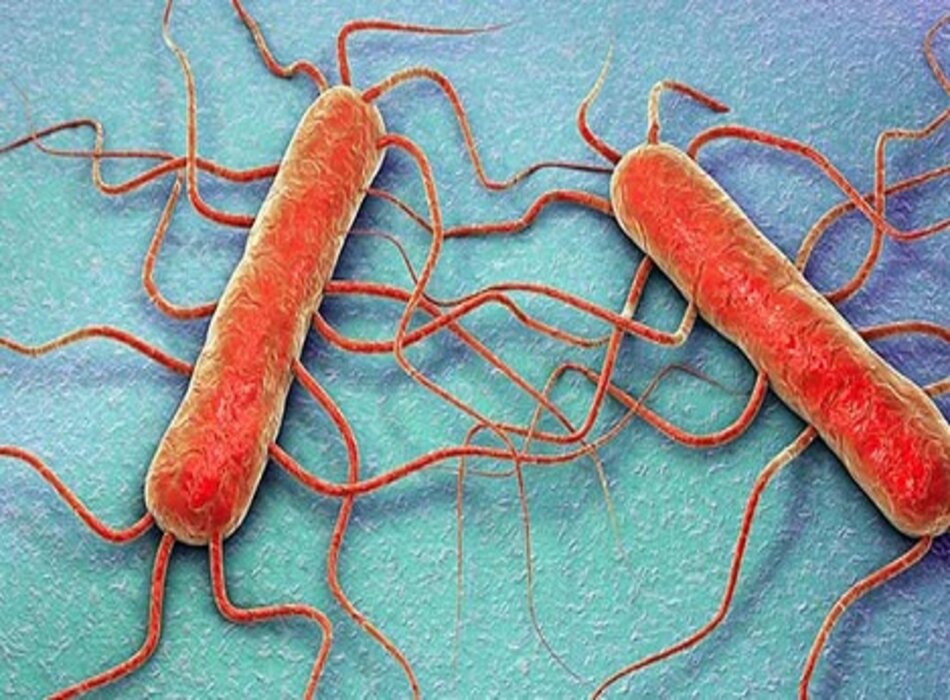 Nhiễm khuẩn Listeria: Nguyên nhân, chẩn đoán và hướng dẫn điều trị theo BMJ