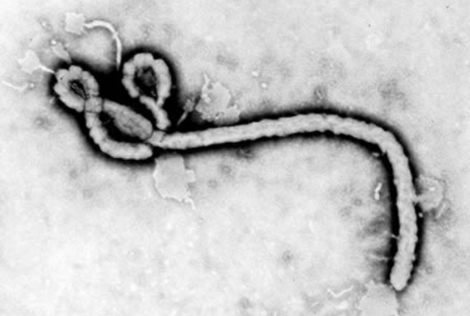 Hình 1: Ảnh hiển vi điện tử về sự lây truyền cho thấy một số hình thái siêu cấu trúc được biểu hiện bởi hạt vi-rút Ebola (Ebola virus virion)