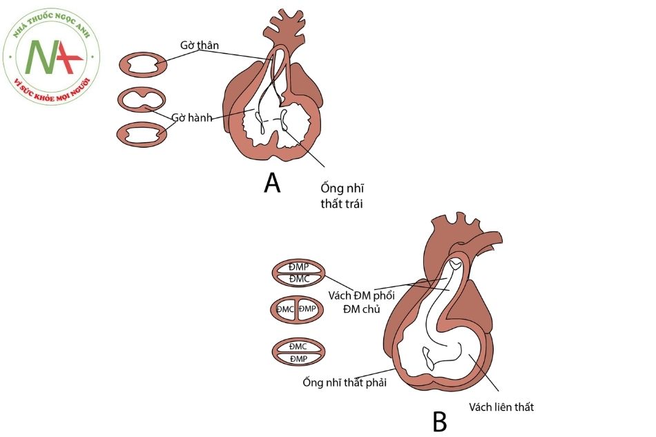 Hình 1. Hình thành vách ngăn tại thân động mạch và nón tim