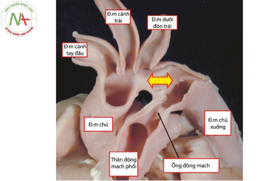 Hình 18. Cấu tạo giải phẫu quai động mạch chủ và ống động mạch