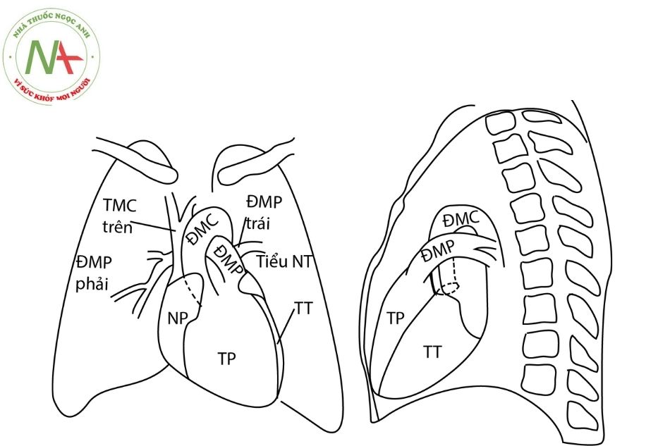 Hình 2. Hình ảnh bóng tim bình thường trên phim chụp ngực thẳng trước sau và nghiêng