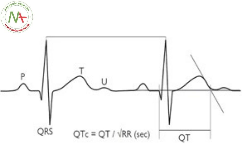 Hình 28. Khoảng QT được đo trên chuyển đạo DII hoặc V5 từ điểm đầu phức bộ QRS đến hết sóng T