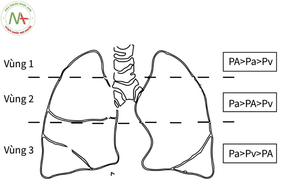Hình 5. Sơ đồ phân chia các vùng phổi theo West Chú thích: PA: áp lực phế nang; Pa: áp lực động mạch phổi; Pv: áp lực tĩnh mạch phổi.