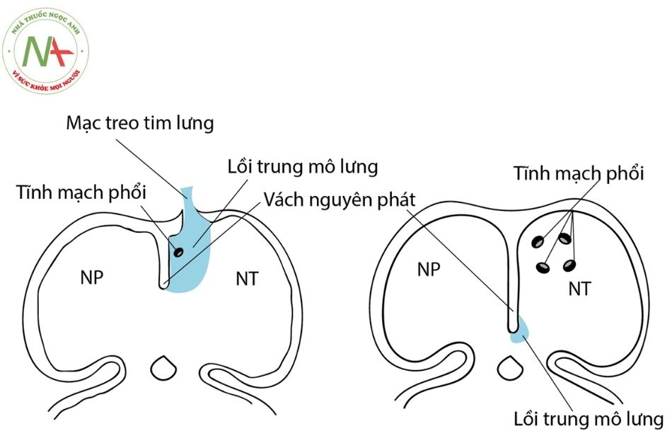Hình 6. Hình ảnh mô tả nguồn gốc phôi thai của tĩnh mạch phổi