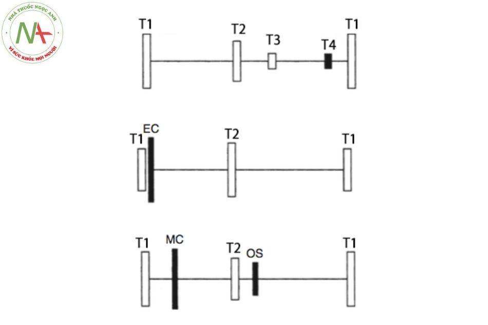 Hình 6. Mối quan hệ giữa các tiếng tim T1, T2, T3, T4, tiếng click tống máu, click giữa tâm thu, clac mở van trong chu chuyển ti