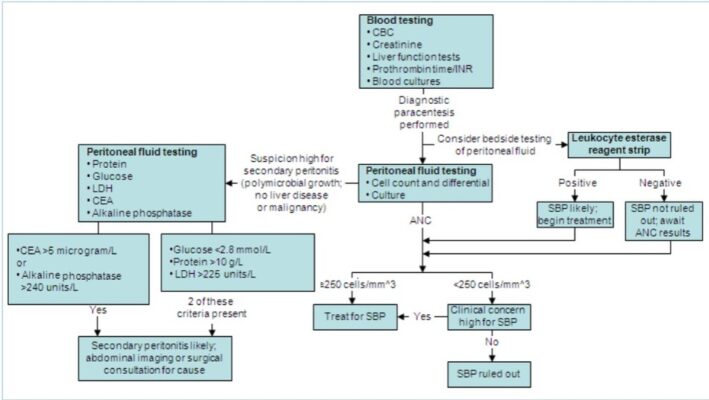 Algorithm for the diagnosis of spontaneous bacterial peritonitis (ANC, absolute neutrophil count; LDH, lactate dehydrogenase; CEA, carcinoembryonic antigen) From the personal collection of Brian Chinnock, MD; used with permission