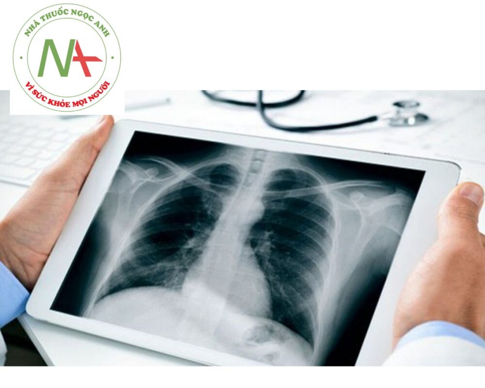 X-quang tim phổi