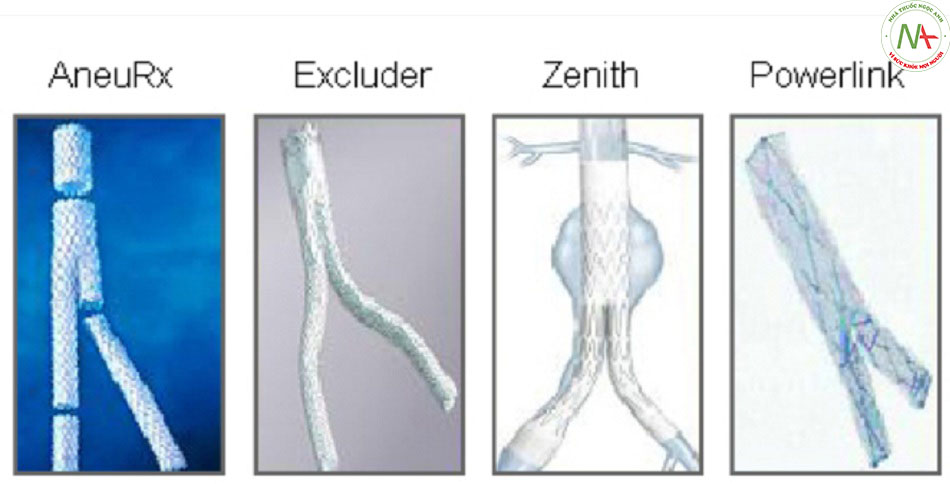 Hình 4: Các mảnh ghép stent nội mạch khác nhau được sử dụng để sửa chữa chứng phình động mạch nội mạch (EVAR)