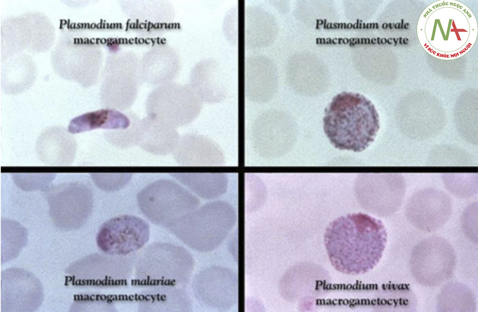 Hình 3: Dàn máu nhuộm Giemsa phát hiện thể giao bào Plasmodium falciparum, P ovale, P malariae và P vivax Thư hiện Hình ảnh Trung tâm Kiểm soát và Phòng ngừa Dịch bênh; đã được phép sử dụng
