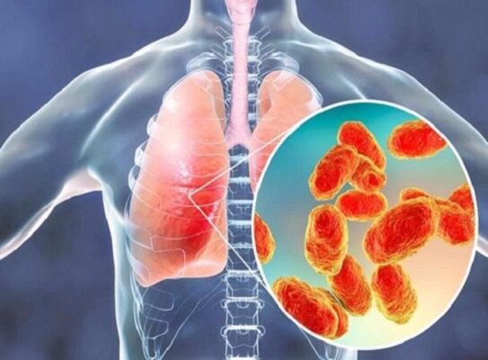 Tổng quan về viêm phổi