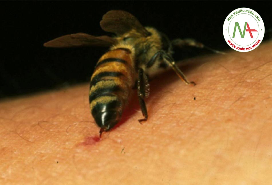 Hình 1: Ong mật đốt thịt